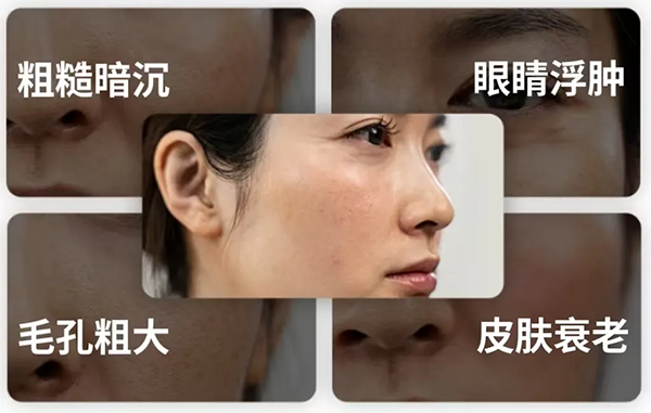 冰磯堂顏究站 | 熬夜后皮膚為何會(huì)變黃？